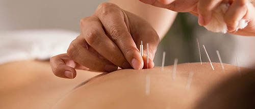 Conditions Treated With Acupuncture