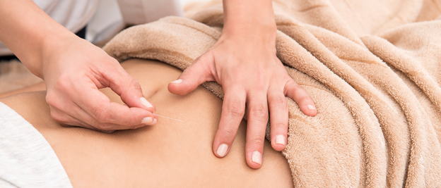 What Is Acupuncture?