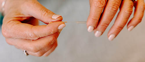 What Is Acupuncture?